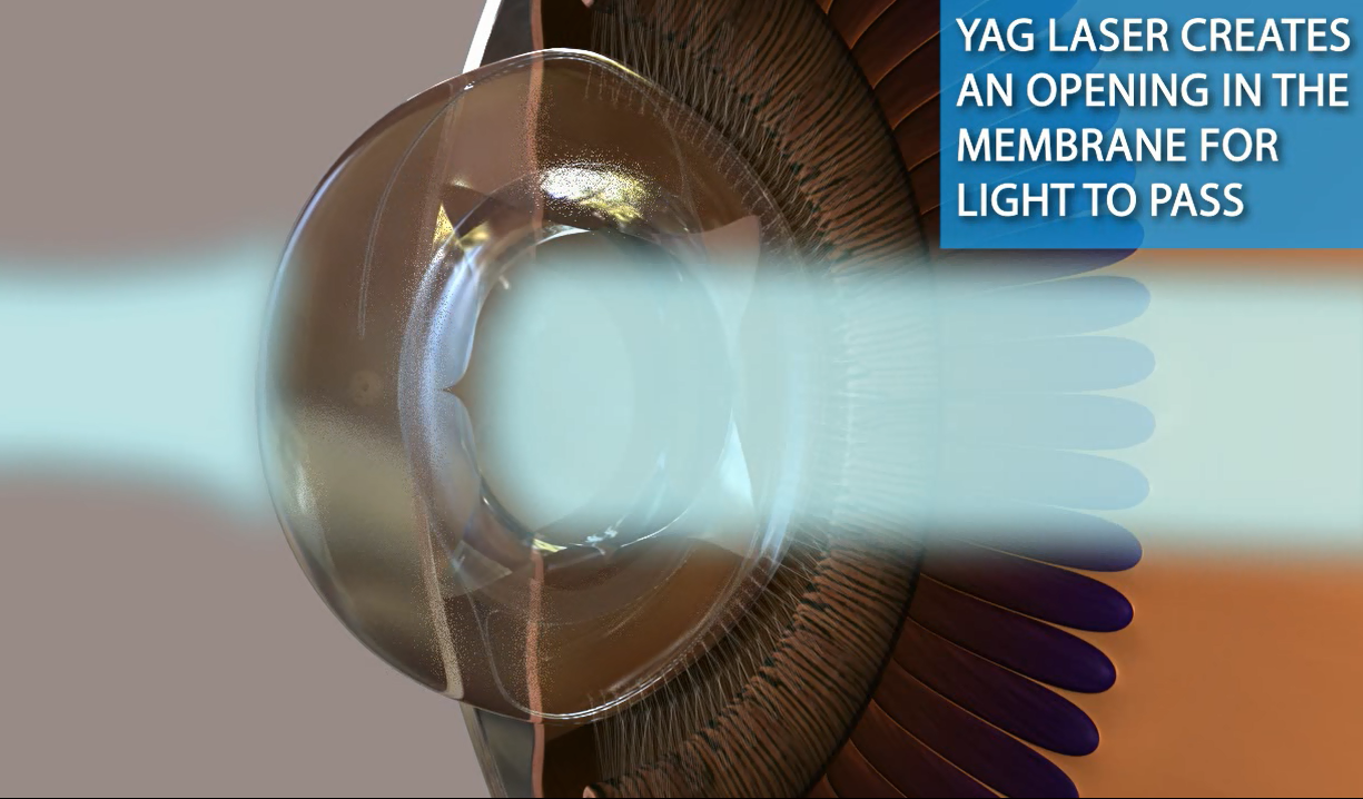 explainer video explainer video