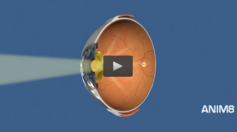 single-anim ophthalmology animations for websites